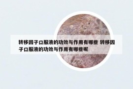 轉移因子口服液的功效與作用有哪些 轉移因子口服液的功效與作用有哪些呢