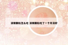 消銀顆粒怎么吃 消銀顆粒吃了一個(gè)月沒(méi)好
