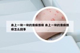 身上一塊一塊的像癬很癢 身上一塊的像癬很癢怎么回事