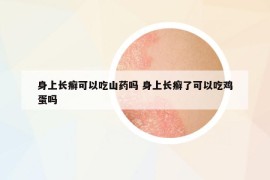 身上長(zhǎng)癬可以吃山藥嗎 身上長(zhǎng)癬了可以吃雞蛋嗎