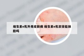 維生素e乳外用皮膚病 維生素e乳軟膏能抹臉嗎