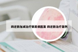 四逆散加減治療銀屑病醫(yī)案 四逆散治療案例