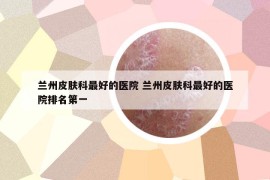 蘭州皮膚科最好的醫(yī)院 蘭州皮膚科最好的醫(yī)院排名第一
