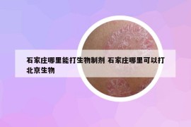 石家莊哪里能打生物制劑 石家莊哪里可以打北京生物