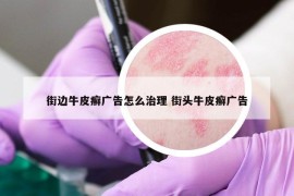 街邊牛皮癬廣告怎么治理 街頭牛皮癬廣告