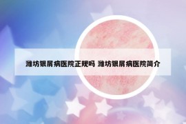 濰坊銀屑病醫(yī)院正規(guī)嗎 濰坊銀屑病醫(yī)院簡介
