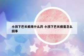 小孩下巴長(zhǎng)癬用什么藥 小孩下巴長(zhǎng)癬是怎么回事