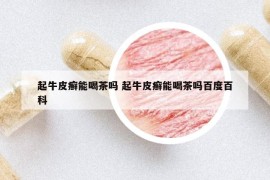 起牛皮癬能喝茶嗎 起牛皮癬能喝茶嗎百度百科