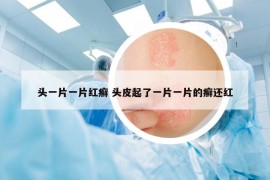 頭一片一片紅癬 頭皮起了一片一片的癬還紅