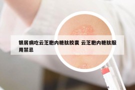 銀屑病吃云芝胞內(nèi)糖肽膠囊 云芝胞內(nèi)糖肽服用禁忌