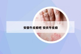 安徽牛皮癬吧 安慶牛皮癬
