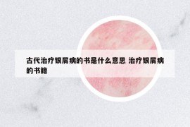 古代治療銀屑病的書是什么意思 治療銀屑病的書籍