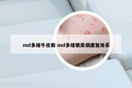 md多維牛皮癬 md多維銀屑病康復體系