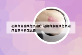 初期白點癲風(fēng)怎么治療 初期白點癲風(fēng)怎么治療北京中科怎么去