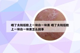 曬了太陽后臉上一塊白一塊黑 曬了太陽后臉上一塊白一塊黑怎么回事