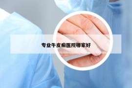 專業(yè)牛皮癬醫(yī)院哪家好