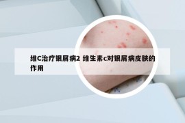 維C治療銀屑病2 維生素c對銀屑病皮膚的作用
