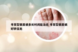 尋常型銀屑病多長時間能治愈 尋常型銀屑病好轉(zhuǎn)征兆