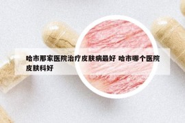 哈市那家醫(yī)院治療皮膚病最好 哈市哪個醫(yī)院皮膚科好