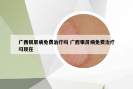 廣西銀屑病免費(fèi)治療嗎 廣西銀屑病免費(fèi)治療嗎現(xiàn)在