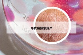 牛皮癬傾家蕩產(chǎn)