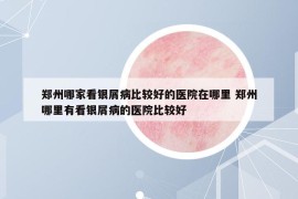 鄭州哪家看銀屑病比較好的醫(yī)院在哪里 鄭州哪里有看銀屑病的醫(yī)院比較好