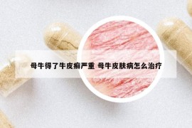 母牛得了牛皮癬嚴(yán)重 母牛皮膚病怎么治療