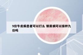 9價(jià)牛皮癬患者可以打么 銀屑病可以接種九價(jià)嗎