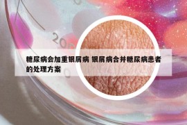 糖尿病會加重銀屑病 銀屑病合并糖尿病患者的處理方案