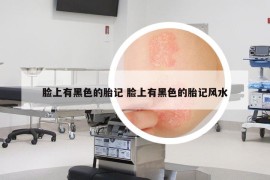 臉上有黑色的胎記 臉上有黑色的胎記風(fēng)水