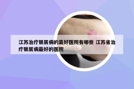 江蘇治療銀屑病的最好醫(yī)院有哪些 江蘇省治療銀屑病最好的醫(yī)院