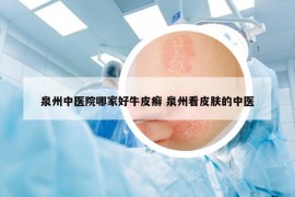 泉州中醫(yī)院哪家好牛皮癬 泉州看皮膚的中醫(yī)