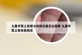 兒童手臂上出現(xiàn)小白斑點(diǎn)是怎么回事 兒童手臂上有白色斑點(diǎn)