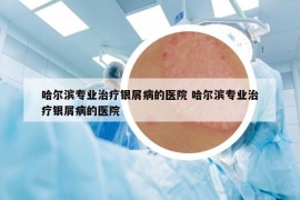 哈爾濱專業(yè)治療銀屑病的醫(yī)院 哈爾濱專業(yè)治療銀屑病的醫(yī)院