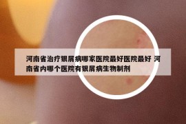 河南省治療銀屑病哪家醫(yī)院最好醫(yī)院最好 河南省內(nèi)哪個(gè)醫(yī)院有銀屑病生物制劑