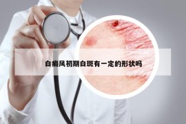白癜風(fēng)初期白斑有一定的形狀嗎