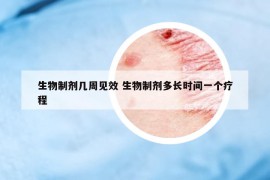 生物制劑幾周見效 生物制劑多長時間一個療程