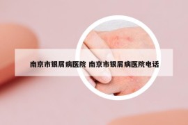 南京市銀屑病醫(yī)院 南京市銀屑病醫(yī)院電話