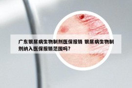 廣東銀屑病生物制劑醫(yī)保報銷 銀屑病生物制劑納入醫(yī)保報銷范圍嗎?