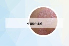 中醫(yī)論牛皮癬