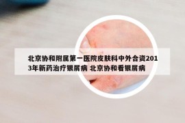 北京協(xié)和附屬第一醫(yī)院皮膚科中外合資2013年新藥治療銀屑病 北京協(xié)和看銀屑病