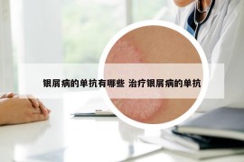 銀屑病的單抗有哪些 治療銀屑病的單抗