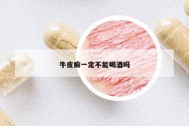 牛皮癬一定不能喝酒嗎