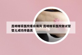 昆明哪家醫(yī)院看白癜風(fēng) 昆明哪家醫(yī)院做試管嬰兒成功率最高