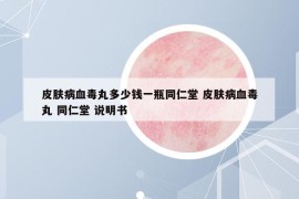 皮膚病血毒丸多少錢一瓶同仁堂 皮膚病血毒丸 同仁堂 說(shuō)明書
