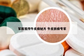 軍醫(yī)祖?zhèn)髋Ｆぐ_秘方 牛皮膚癬專家