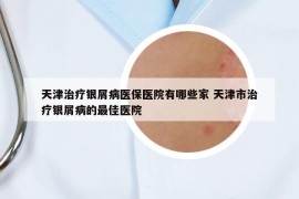 天津治療銀屑病醫(yī)保醫(yī)院有哪些家 天津市治療銀屑病的最佳醫(yī)院