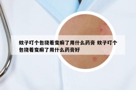 蚊子叮個(gè)包撓著變癬了用什么藥膏 蚊子叮個(gè)包撓著變癬了用什么藥膏好