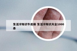 生活冷知識(shí)牛皮癬 生活冷知識(shí)大全1000條