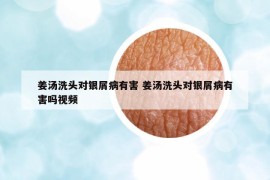 姜湯洗頭對銀屑病有害 姜湯洗頭對銀屑病有害嗎視頻